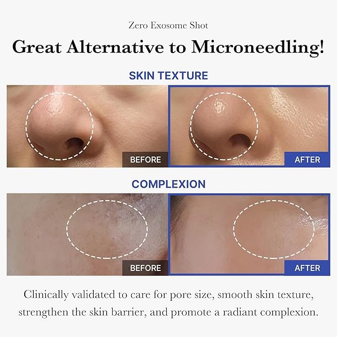 medicube Zero Exosome Shot 7,500 PPM Spicule Facial Serum